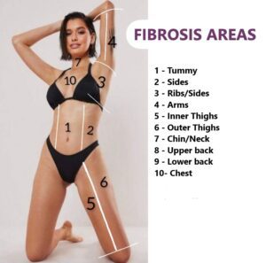 Fibrosis areas of treatment